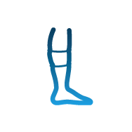 Усещане за стягане като симптом за хронична венозна недостатъчност