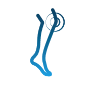 Скованост в ставите като симптом на лошо кръвообращение